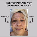 Removedor de Rugas FIRM-A-TITE™