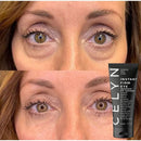 Removedor de Rugas FIRM-A-TITE™